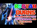 Ruqyah verses that burn jinns and Satan in the body and those that nest in the house