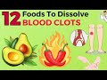 Surprising Foods That Dissolve Blood Clots Naturally (Doctors Won't Share)