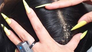 Fall Asleep Fast 🌙 ASMR Peaceful Scalp Care & Gentle Hair Cleaning for Relaxation VF000290