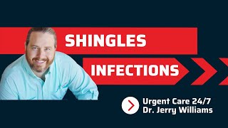 What You Need to Know About Shingles