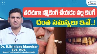 స్మోకింగ్‌తో దంత సమస్యలు || Effects of Smoking on Oral Health in Telugu || Manohar Dental