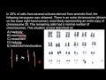 Haploidy, Monosomy, Mosaicism, Triploidy and Balanced Translocation explained