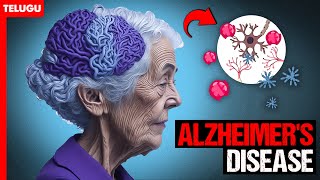 💡ప్రతి విషయాన్ని మర్చిపోతున్నారా?💡ALZHEIMER's : Causes, Symptoms, and Treatments || ZOOMED || Telugu