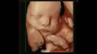 HDLIVE ULTRASOUND AT 28 WEEKS, PERFECT BABY! A New Conception Hanover, Ma