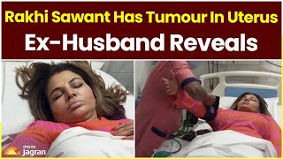 'Rakhi Sawant Has Tumor In Uterus': Ex Husband Reveals | Entertainment News | Jagran English News