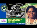 FIRST TRIMESTER ANOMALY SCAN | How I do it by Alpana Joshi | FETAL IMAGING | NASAL BONE & NT