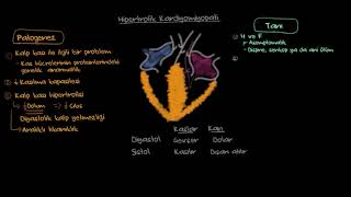 Hipertrofik Kardiyomiyopati: Patofizyolojisi ve Tanısı (Sağlık Bilgisi ve Tıp)