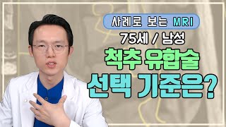 [새로운병원 척추보안관] 7년동안 주사 치료로 버티다, 결국 유합술을 하게 된 이유는?(75세 남성 실제사례)