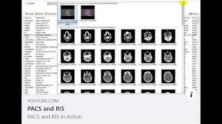 PACS And RIS In Action