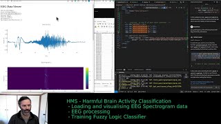 Mastering EEG Data Visualization: Plotly vs. Chart.js Showdown