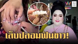 ประกวดธิดาช้าง ใช้เล็บปลอมทำฟันขาว รับแก้ขัดใช้กาวตราช้างติด | ข่าวเที่ยงอมรินทร์ | 21 เม.ย.66