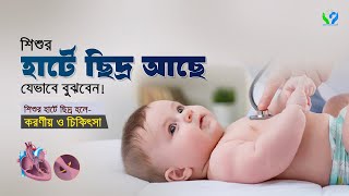 শিশুর হার্টে ছিদ্র আছে যেভাবে বুঝবেন। হার্টে ছিদ্র হলে করণীয় ও চিকিৎসা । Child Heart disease.