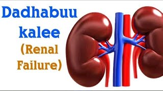 DADHABUU KALEE ( DHUKKUBA KALEE) || renal failure || DAREE SHOW