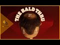 Burger King: The Bald Thru