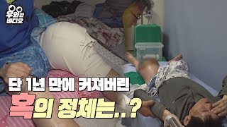 다리에 혹을 얻고 자유를 뺏겨버린 남자┃A man who got lump on leg and lost freedom