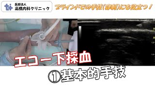 エコー下採血　①基本的手技