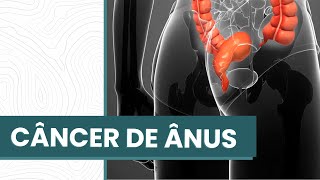 O que é câncer de ânus?