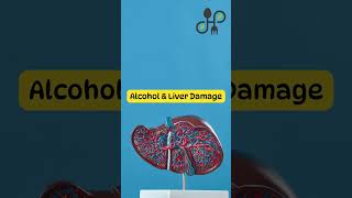 How Alcohol Affects Liver Function Over Time #viralshorts #liverhealth #alcoholeffects