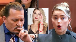 Amber Heard’s Evidence Prove That Alleged Scars Are LIES!