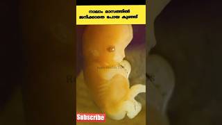 ,നാലാം മാസത്തിൽ ജനിക്കാതെ പോയ കുഞ്ഞ് #pregnancy #education #shorts