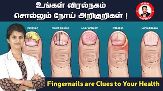 நகத்தில் ஏற்படும் தோற்றத்தை வைத்து நோயை கண்டறிவது எப்படி ? Fingernails are Clues to Your Health!