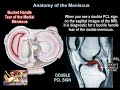 Meniscus TEARS- Everything You Need To Know - Dr. Nabil Ebraheim