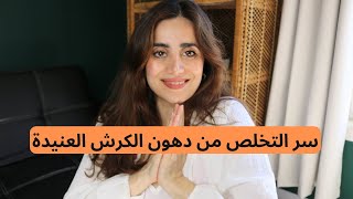 ١٠ خطوات مضمونة للتخلص من الكرش | سر التخلص من دهون البطن العنيدة للابد