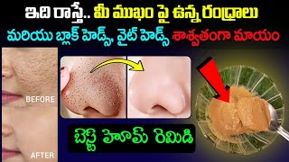 ఇదిరాస్తే మీముఖంపై ఉన్నరంధ్రాలు బ్లాక్ హెడ్స్,వైట్ హెడ్స్ శాశ్వతంగామాయం||Remedy To Remove Open Pores