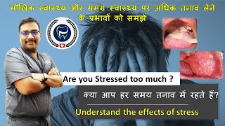 Dr Rudra Mohan |STRESSED OUT?|क्या आप हर समय तनाव में रहते हैं?|मौखिक स्वास्थ्य पर प्रभावों को समझें