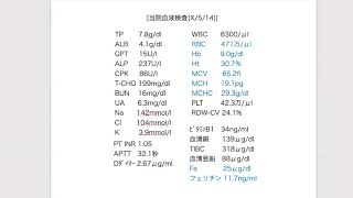 【臨床推論】多発脳梗塞①【症例提示】