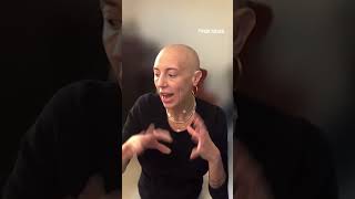 Woman living with alopecia reacts to 4B movement