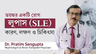 লুপাস রোগ কি, এই রোগের লক্ষণ ও চিকিৎসা | Systemic Lupus Erythematosus SLE Symptoms & Treatment