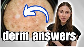 Dermatologist Answers Skincare Questions | Sun Spots, Tretinoin, KP & More