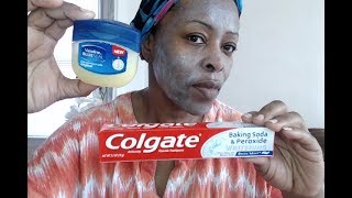 COLGATE BAKING SODA PEROXIDE TOOTHPASTE VASELINE FACE NECK DARK SPOT HYPER PIGMENTATION REMOVAL