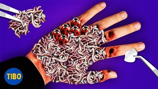 ASMR ANIMATION TREATMENT Remove maggot worm & dog tick from Infected dirty hand Trypophobia anime