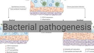 Bacterial pathogenesis