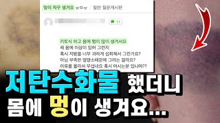 저탄고지하면 멍이 생기는 이유. (저탄고지, 간헐적단식하면 꼭 보세요)