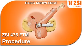 ZSI 475 FTM - Procedure (english version)