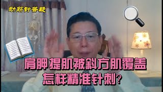 德医堂｜肩胛提肌被斜方肌覆盖怎样精准针刺？