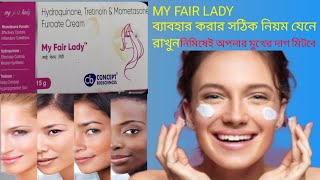 May Fair lady Cream Uses Side Effects Price/মাই ফেয়ার লেডি ক্রিম এর ব্যবহার কি কি