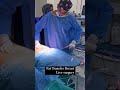 Breast Fat graft Surgery - Breast Fat graft  before and after - live breast increase with fat graft