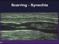 sonographic evaluation of lower extremity venous disease