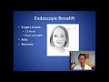 How Can I Lift My Droopy Eyebrows - Browlift Consultation - Dr. Anthony Youn