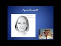 How Can I Lift My Droopy Eyebrows - Browlift Consultation - Dr. Anthony Youn