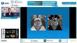 Πολυπαραμετρική Μαγνητική Τομογραφία: Διλήμματα \u0026 παγίδες στη διάγνωση καρκίνου προστάτη | Λάσπας Φ.