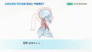 스마트 폰의 과도한 사용이 거북목 증후군을 부른다?