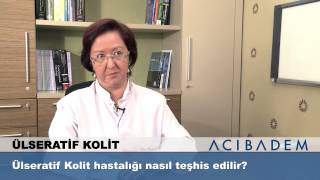 Ülseratif Kolit hastalığı nasıl teşhis edilir?