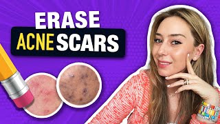 How to Treat & Fade Acne Scars like a Dermatologist! | Dr. Shereene Idriss