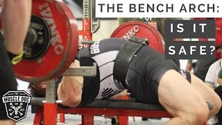 The Bench Arch: Is it Safe?