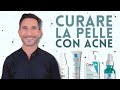 COSMETICI PER CURARE LA PELLE CON ACNE